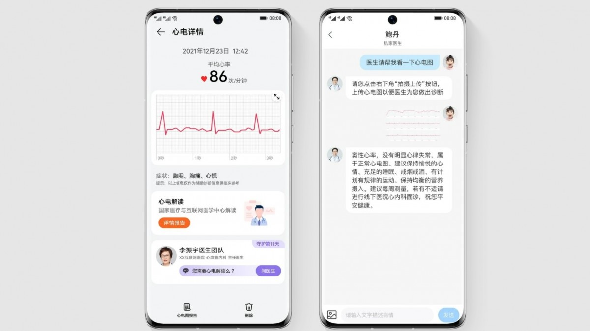 أعلنت Huawei Watch D عن ميزة تخطيط القلب ومراقبة ضغط الدم