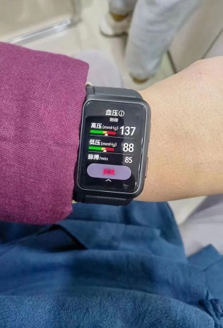 صندوق Huawei Watch D وقراءات ضغط الدم (الصور: عبر Weibo)